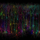 Illustration for article titled Biologists Discover Tiny Neural Computers in the Brain